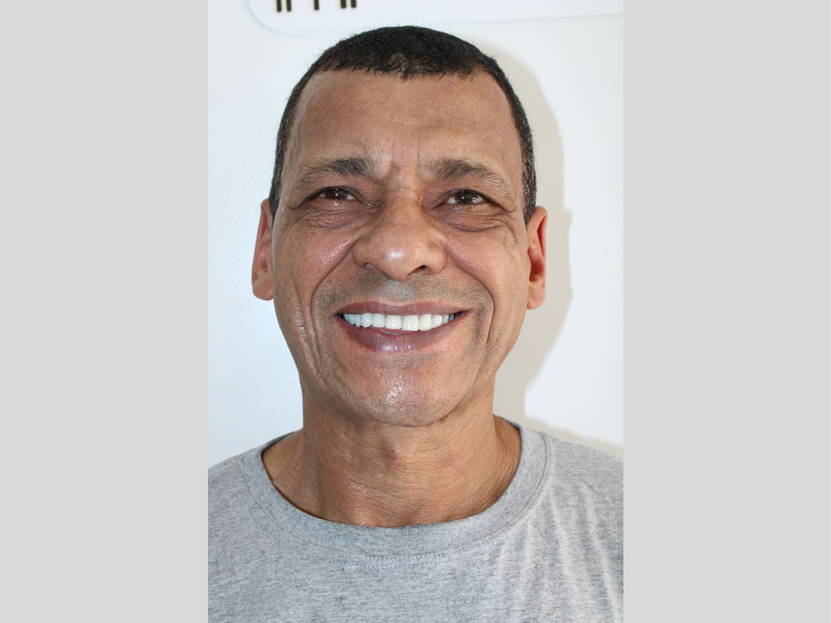 Protocolo de Carga Imediata