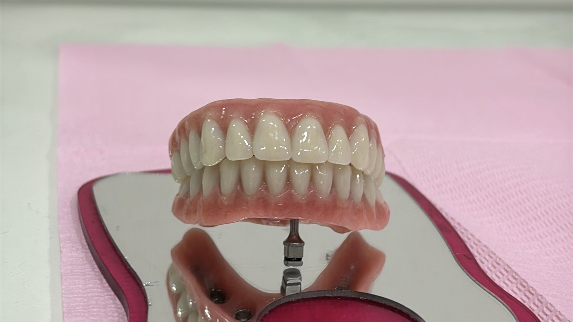 Protocolo de Carga Imediata